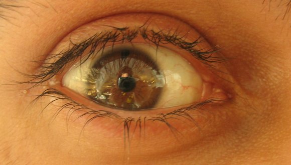 in het oog van een ander